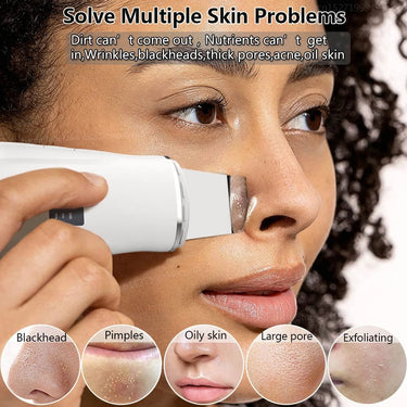 Ultrasonic Blackhead Remover & Facial Skin Scrubber - Skin Lifting and Pore Cleaning - Epic Trends and Gifts - Skincare - S26a6ad52e3784b1a840ca953cb635f04v